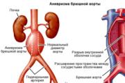 Causes of pulsation and movement in the abdomen